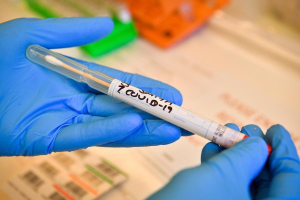 ABD, 5 dakikada sonuç veren 'koronavirüs test kiti' geliştirdi