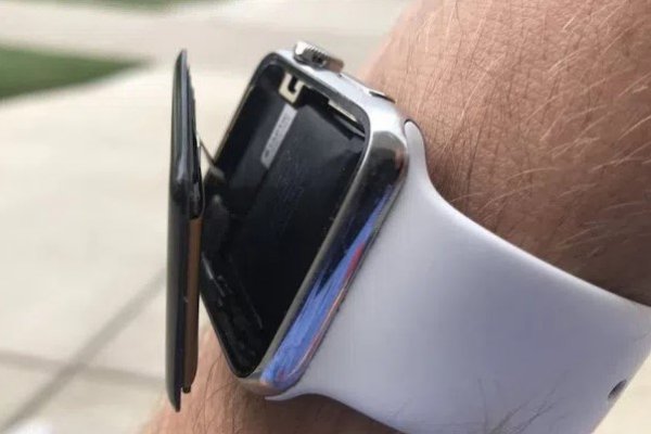 Apple Watch'lardaki tasarım hatası şaşkınlık yarattı
