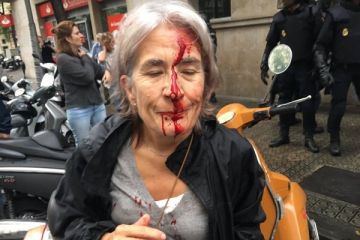 İspanya'da kanlı referandum: 844 yaralı