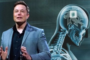 Elon Musk'ın Neuralink şirketi insana beyin çipi yerleştirdi